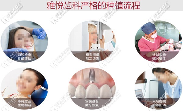 嚴格的種植牙流程