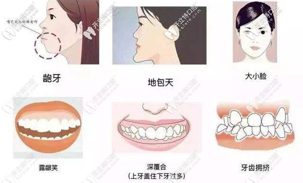 你是否有地包天、虎牙、齙牙、牙列不齊等牙齒問題