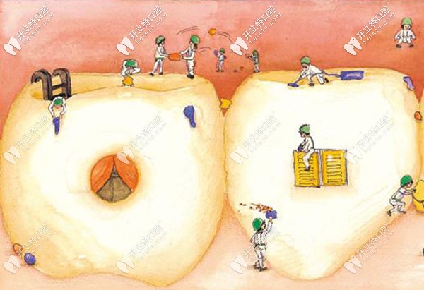 6000元、8000元、9000元甚至上萬(wàn)元的種植牙有沒(méi)有區(qū)別