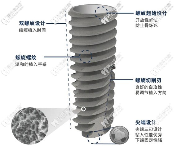 不同品牌種植體的材料也不同