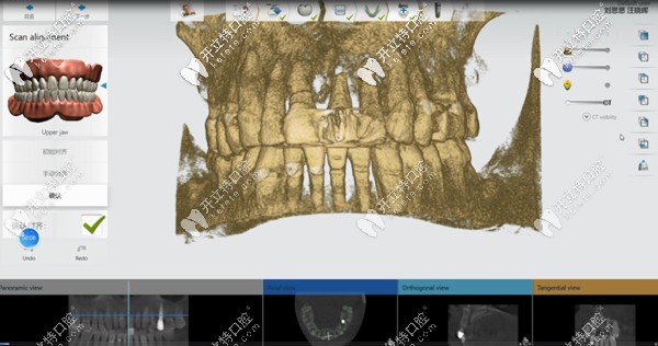 時(shí)代天使數(shù)字化矯正系統(tǒng)