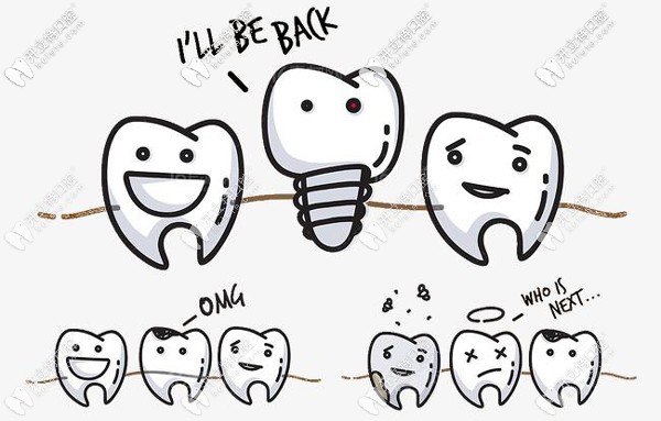 韓國登騰Dentium種植體
