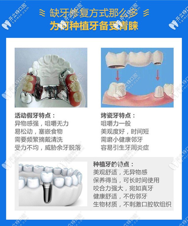 種植牙的優(yōu)勢