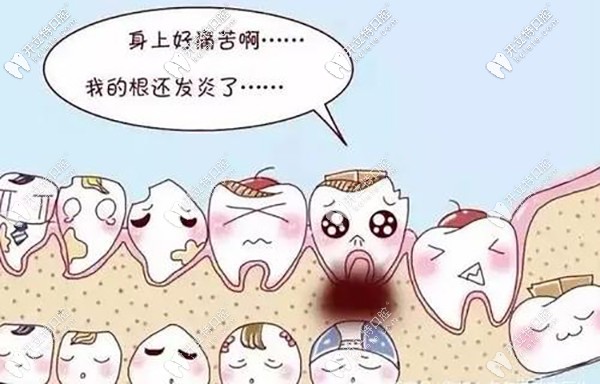 再和你聊聊發(fā)炎和干槽癥的區(qū)別？干槽癥前兆是啥樣？