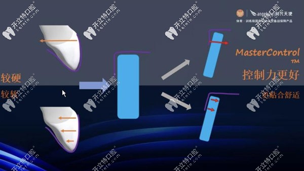 抗蠕變性強的材料，可以更加的控制牙齒