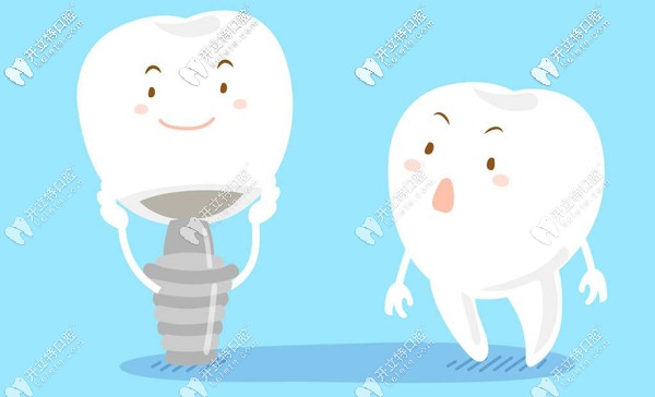 解鎖佛山曙光金子口腔種植牙多少錢一顆？技術(shù)可靠嗎~