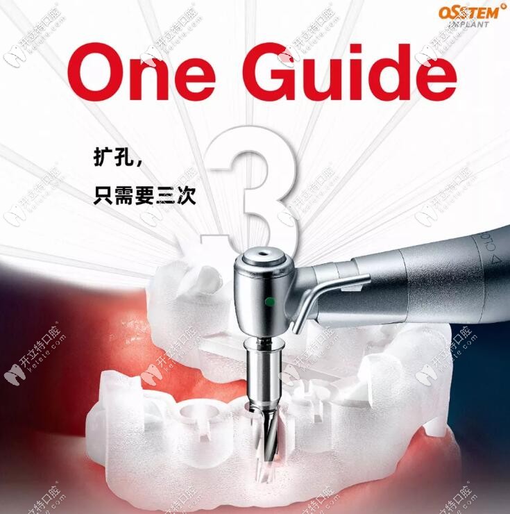 介紹:韓國奧齒泰IMPLANT種植牙數(shù)字化導(dǎo)板是干什么用的