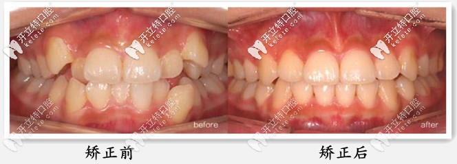 陽瓊醫(yī)生復雜案例圖