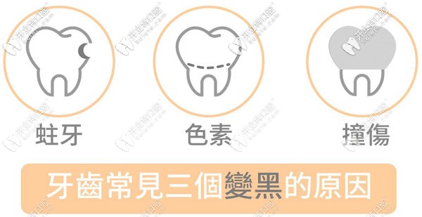 兒童牙齒黑斑是什么原因引起的，需要治療嗎？