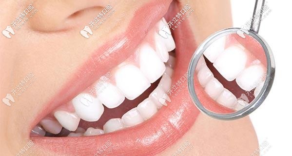 本月在廣州柏德做牙齒矯正還送牙齒美白