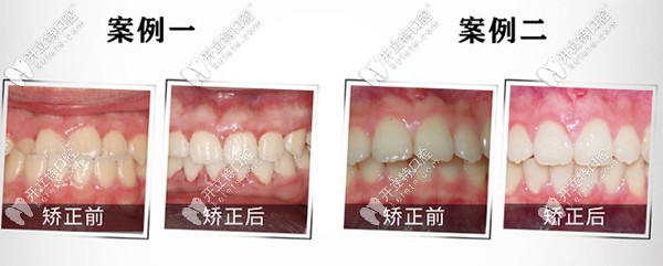 重慶團(tuán)圓私立口腔醫(yī)院到底好不好？是連鎖牙科么？