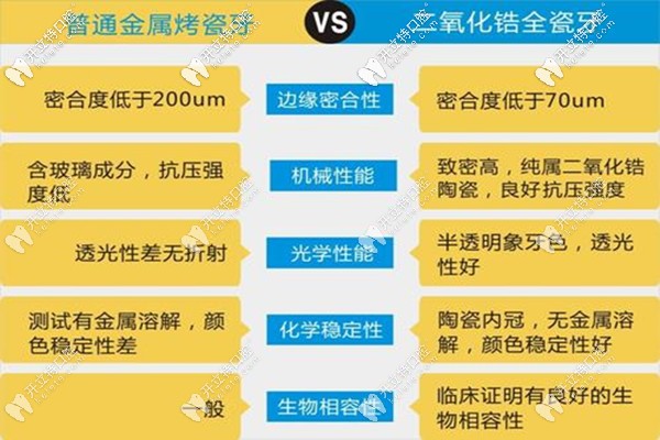 烤瓷牙和全瓷牙的區(qū)別