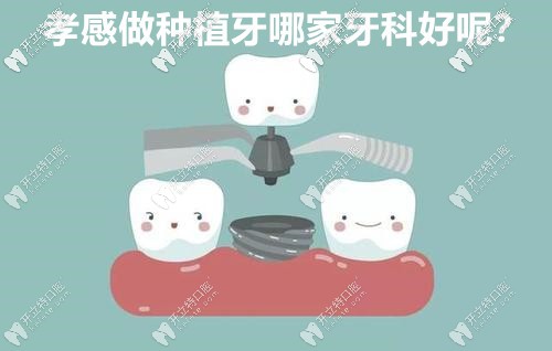 分享孝感做種植牙比較好的牙科醫(yī)院,有種牙價格表附送哦