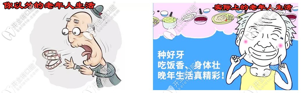 老人掉了很多牙怎么辦？看58歲楊女士的種牙體驗(yàn)