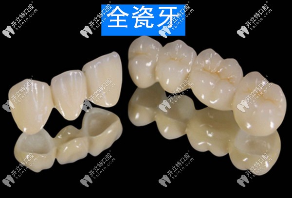 騰沖德博口腔全瓷牙的價格