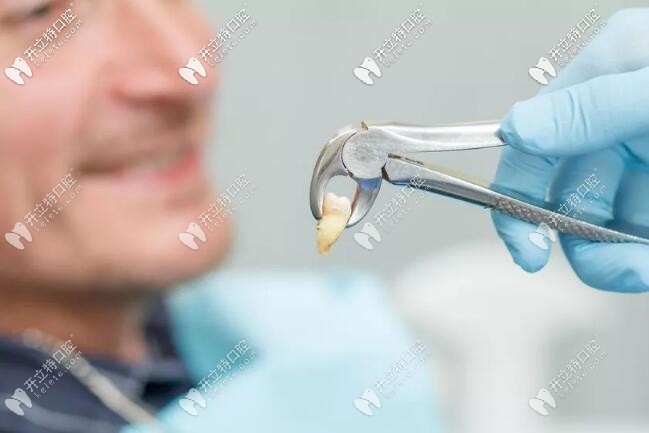 有哪些疾病不易拔牙