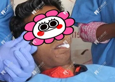 羅地亞男子有一顆異常大的牙齒