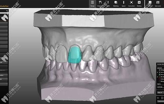 美學(xué)設(shè)計修復(fù)