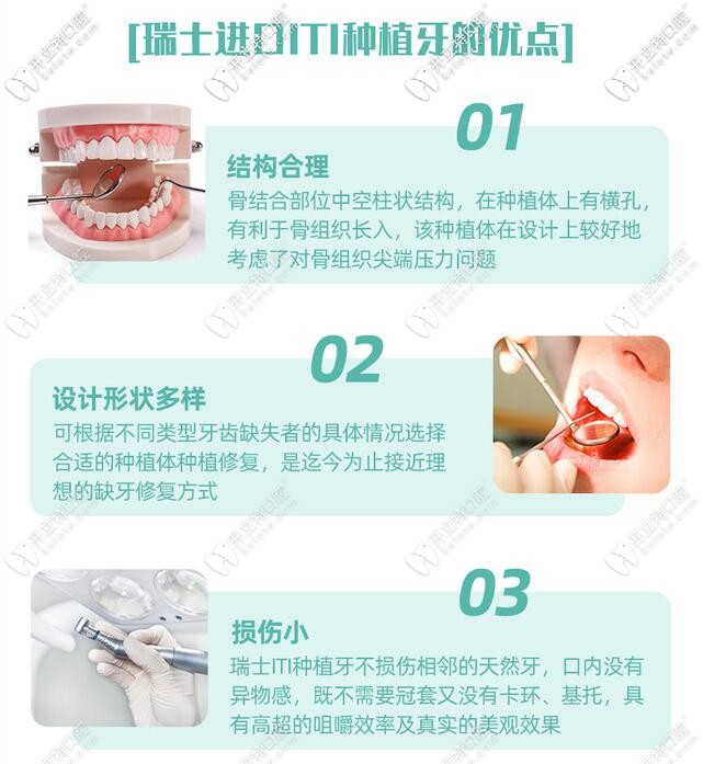 向輝主任介紹——瑞士進(jìn)口iti種植牙的優(yōu)點