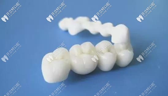 全瓷牙冠的外觀
