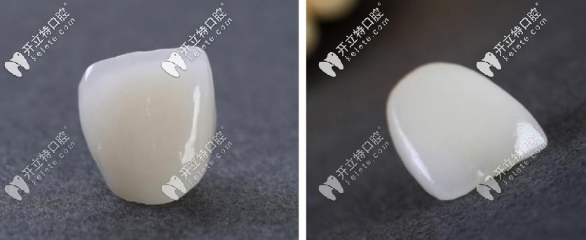 戴立克全瓷牙外觀