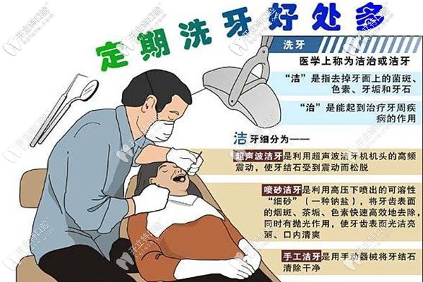 達(dá)州正規(guī)牙科醫(yī)院洗牙一般多少錢一次,收費價格你拿去