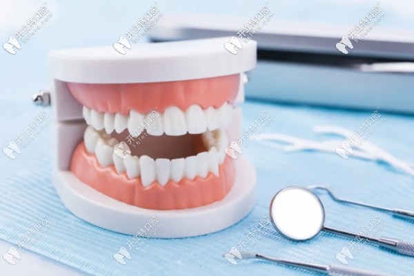 全口種植牙上下6顆牙根這個(gè)allon6即刻負(fù)重技術(shù),得多少錢大概