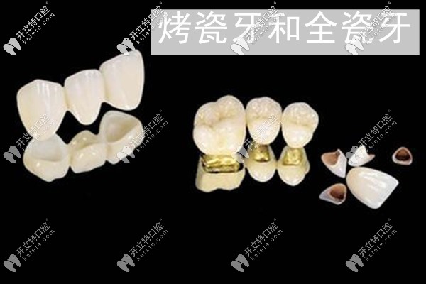 東莞莞大口腔做牙冠的價格