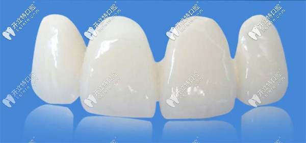 國產(chǎn)美晶瓷PK愛爾創(chuàng)全瓷牙哪個好？來看價格及優(yōu)缺點(diǎn)~