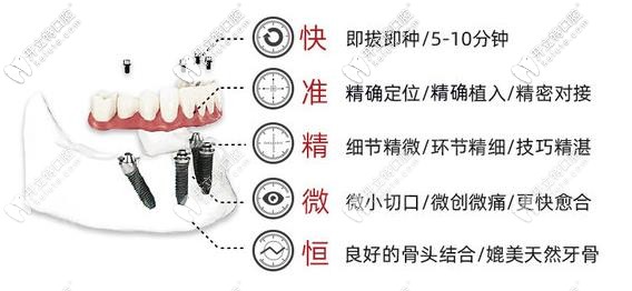 即刻種植、即刻負重技術優(yōu)勢