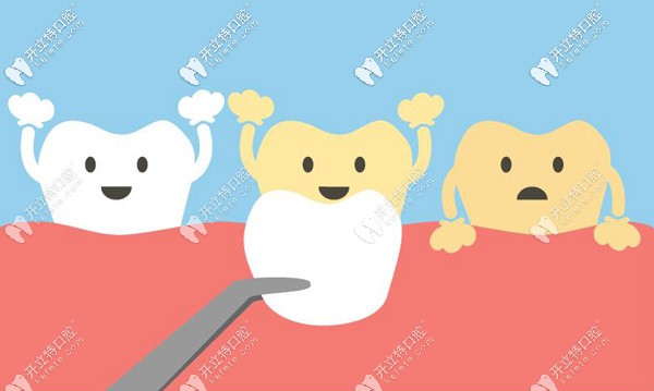 長久使用容易變色