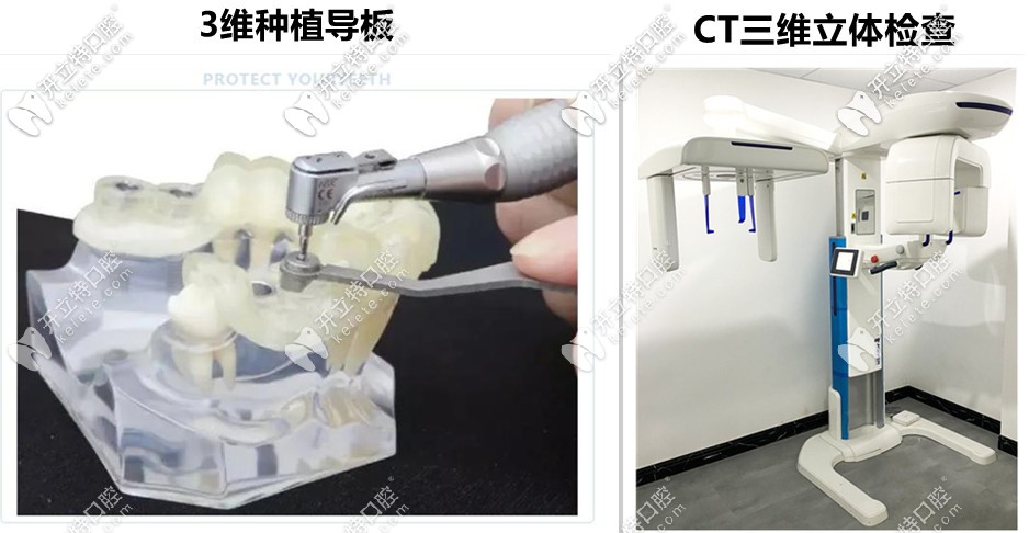 益陽德益口腔—先進數(shù)字化設備