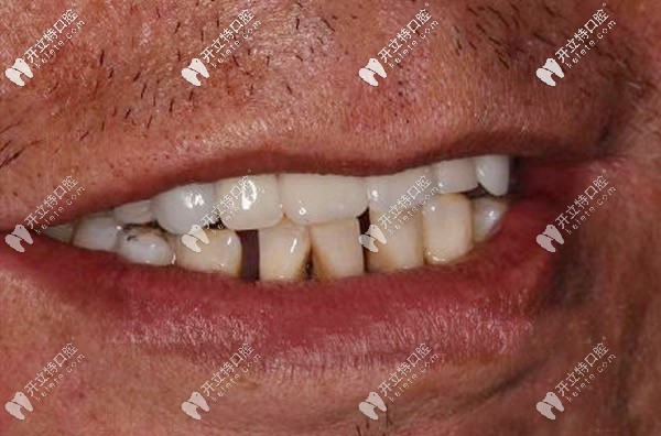 王老先生再不用為吃東西擔心 王老先生再不用為吃東西擔心