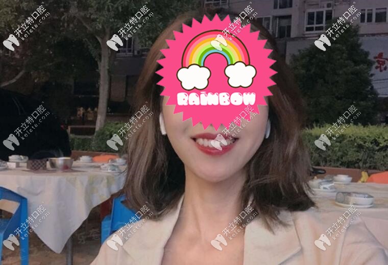 牙齒矯正后圖片