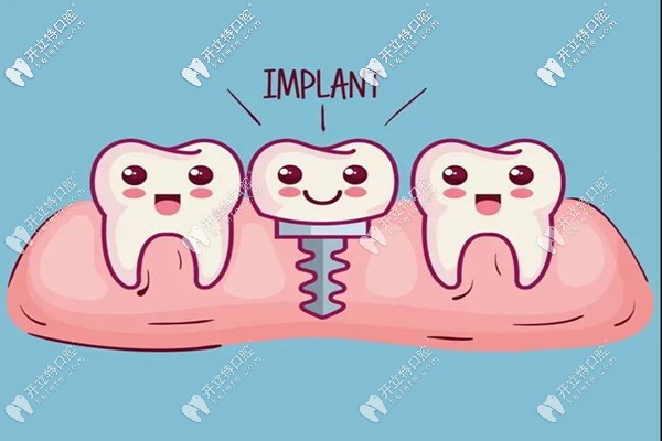 種牙后一星期食譜