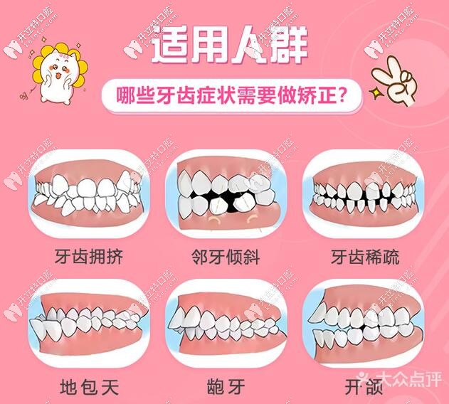 哪些牙齒問題需要矯正