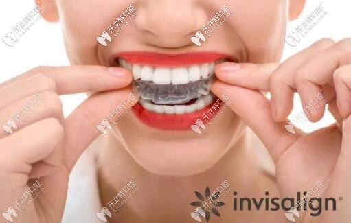 隱適美是按副算錢的嗎?價(jià)格和牙套數(shù)量有關(guān)嗎