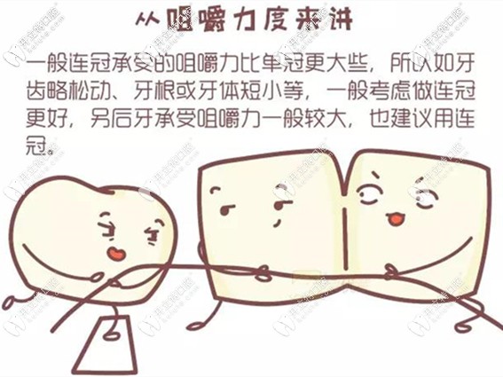 全瓷牙單冠好還是連冠好 全瓷牙單冠好還是連冠好