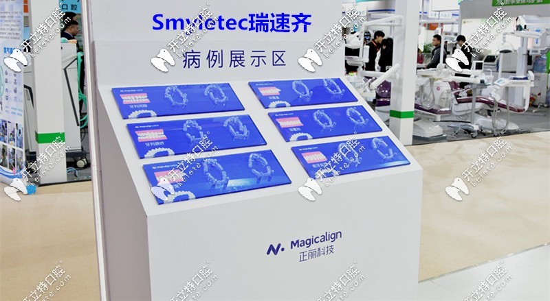 瑞速齊隱形牙套由：天津正麗科技和士卓曼集團聯(lián)合推出的