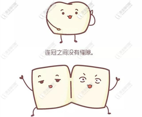 單冠和連冠全瓷牙的利弊 單冠和連冠全瓷牙的利弊