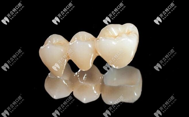 進(jìn)口氧化鋯全瓷牙