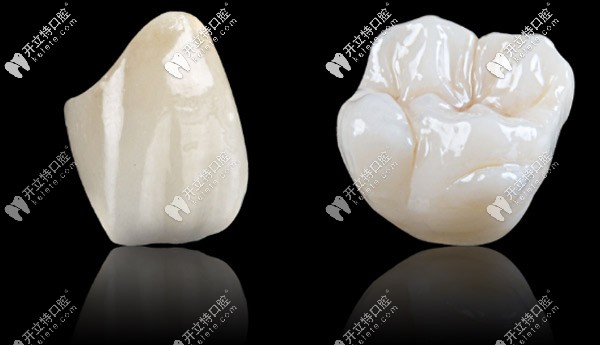 格萊美全瓷牙是進(jìn)口的嗎，做一顆的價(jià)格大概是多少？