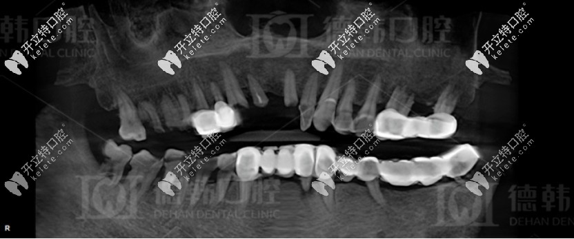 種植前爺爺?shù)难榔? alt=