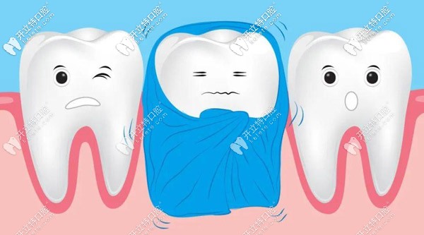 青島各牙科醫(yī)院補牙多少錢一顆