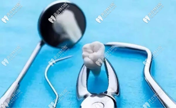 運用超聲骨刀拔牙的優(yōu)點