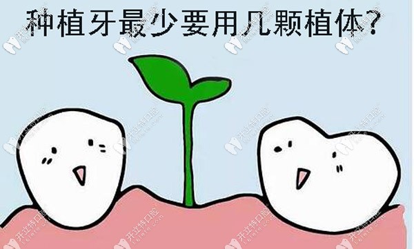 全口種植牙較少要做多少顆？其實跟種牙方案的選擇有關(guān)
