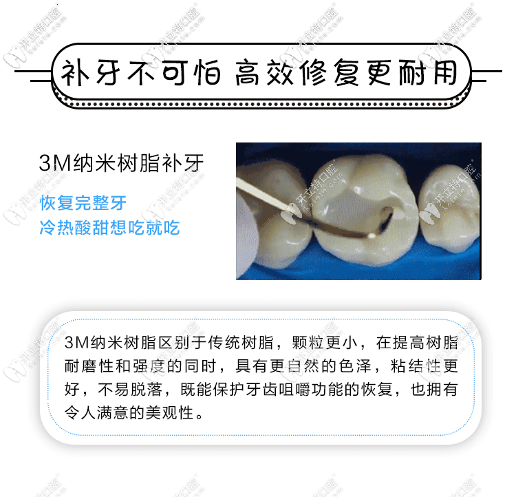 美國(guó)3m樹(shù)脂補(bǔ)牙