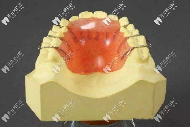 無功能平面牙合墊式上下活動矯治器