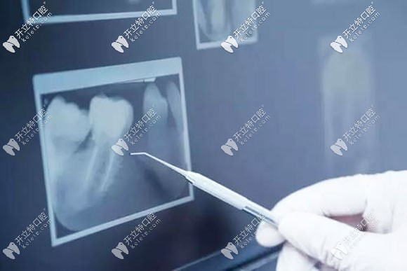 口腔醫(yī)院放射科的項(xiàng)目介紹