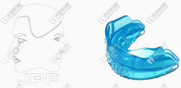 jpf兒童肌功能矯治器矯正效果好不好?它與MRC適應癥有區(qū)別嗎